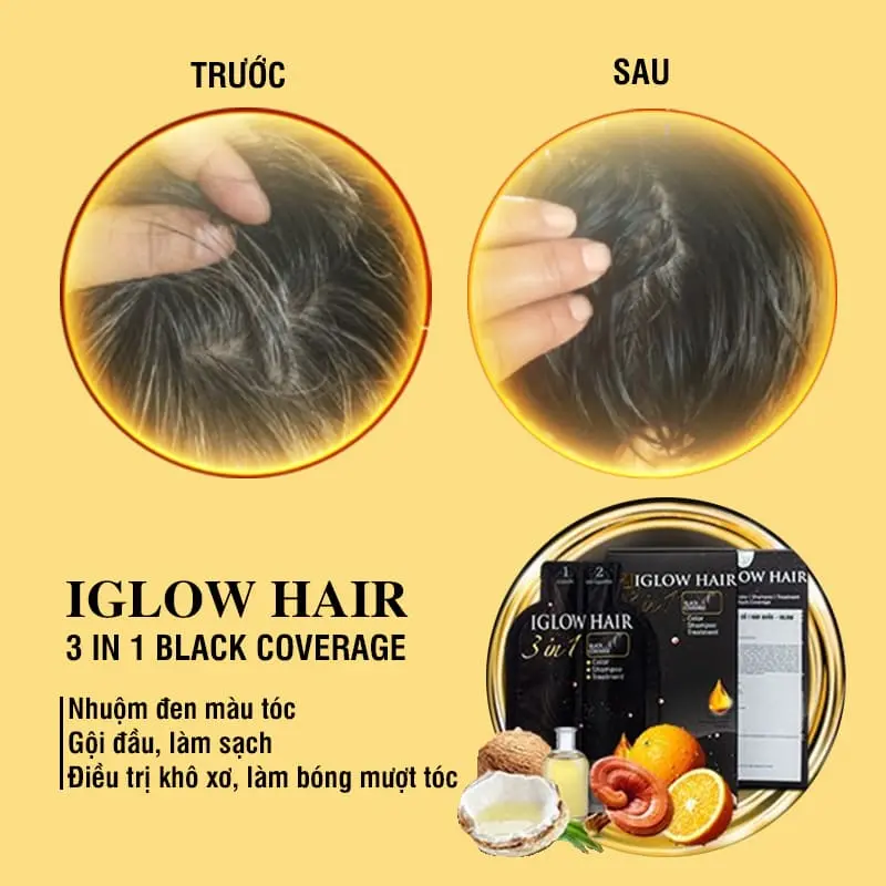 feedback iglow hair - review iglow hair - iglow hair có tốt không - iglow hair có hiệu quả không - Droppii Mall - 2