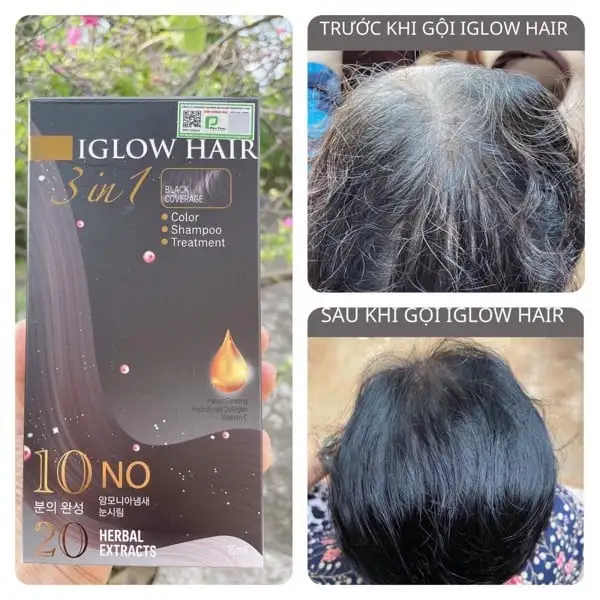 feedback iglow hair - review iglow hair - iglow hair có tốt không - iglow hair có hiệu quả không - Droppii Mall - 3