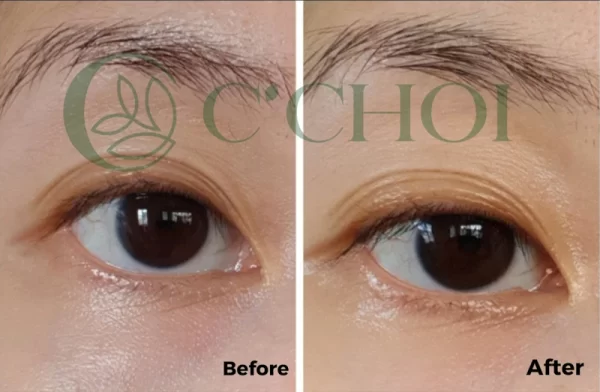 Review Tinh Chất Dưỡng Mắt 3 Tác động C’choi - Triple Effect Eye Serum