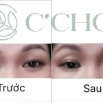 Review Tinh Chất Dưỡng Mắt C’choi 3 Tác động - Triple Effect Eye Serum