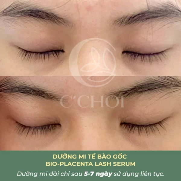 Review Dưỡng Mi Tế Bào Gốc C'choi - Bio-placenta Lash Serum - Punar - Droppii Mall - Hình 13