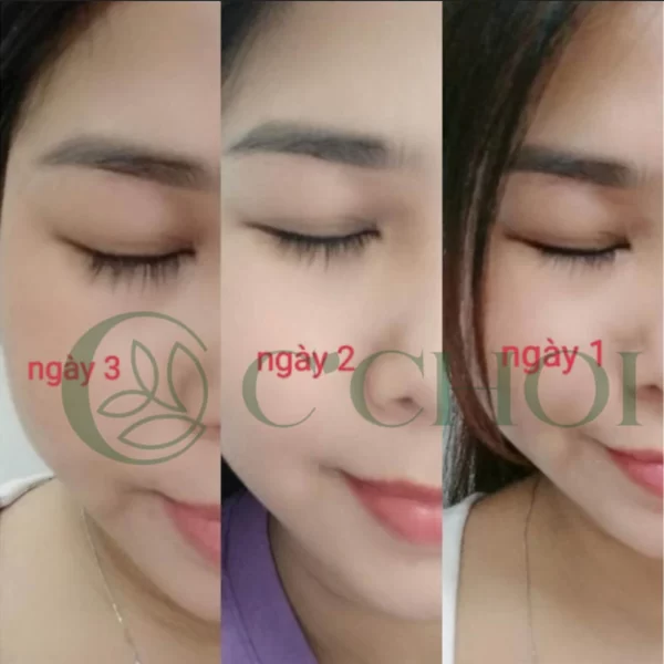 Review Dưỡng Mi Tế Bào Gốc C'choi - Bio-placenta Lash Serum - Punar - Droppii Mall - Hình 5